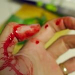 accident, bleed, bleeding-743035.jpg